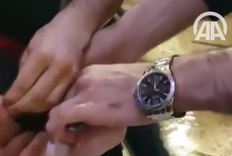 A watch shows time of hospital treatmeant of Douma chemical attack victims